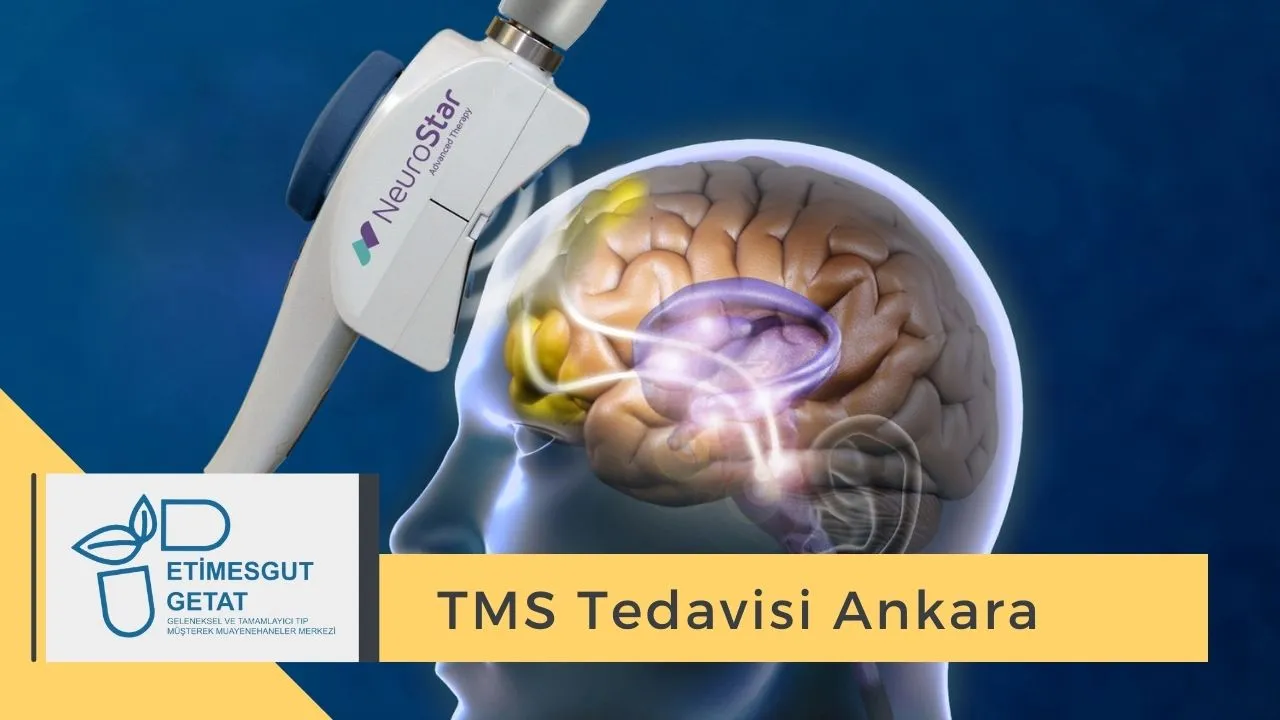 TMS Tedavisi Ankara