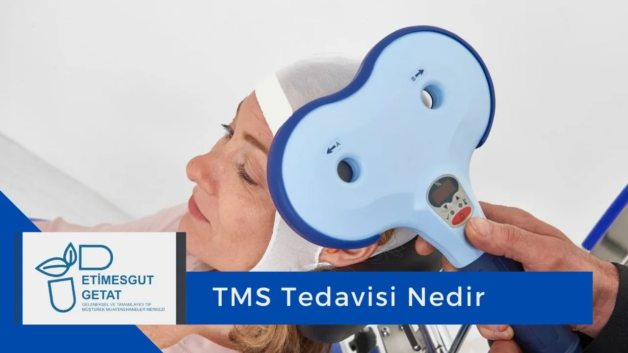 TMS Tedavisi Nedir?