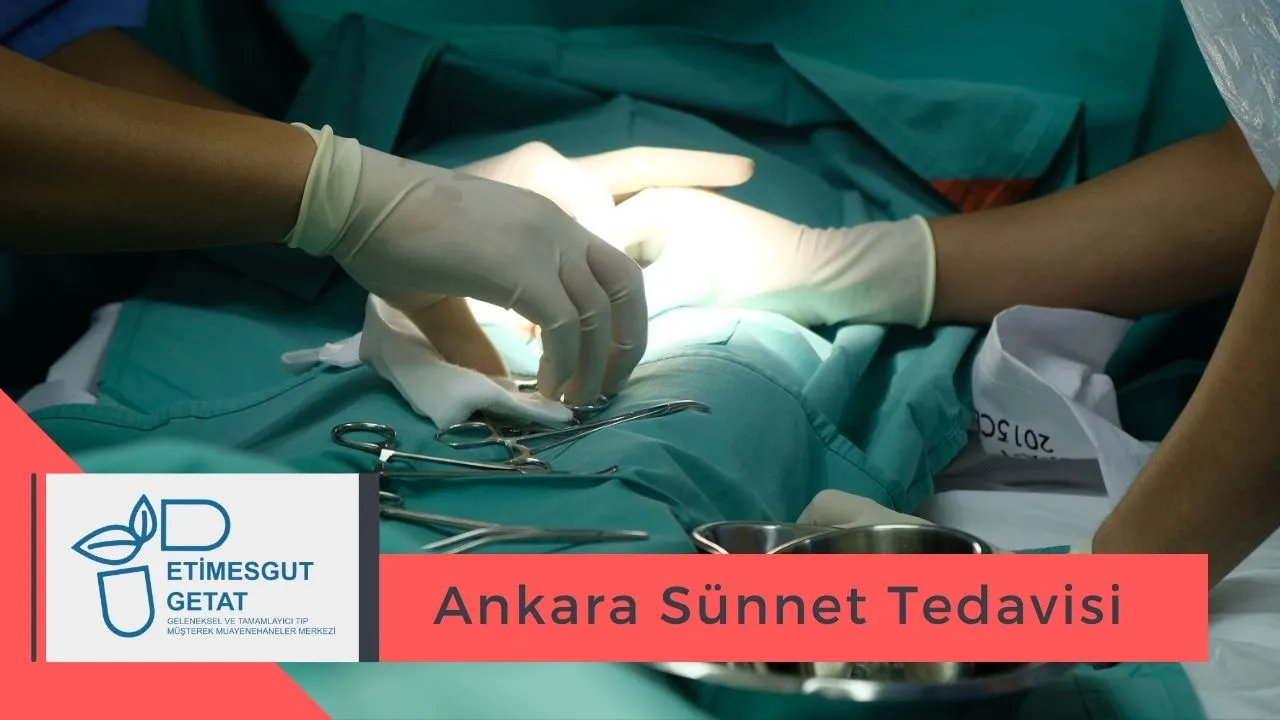 Ankara Sünnet Tedavisi