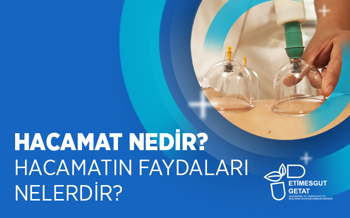Hacamat Nedir? Hacamatın Faydaları Nelerdir?